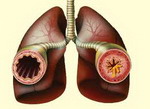 Как лечить бронхиальную астму без гормонов thumbnail